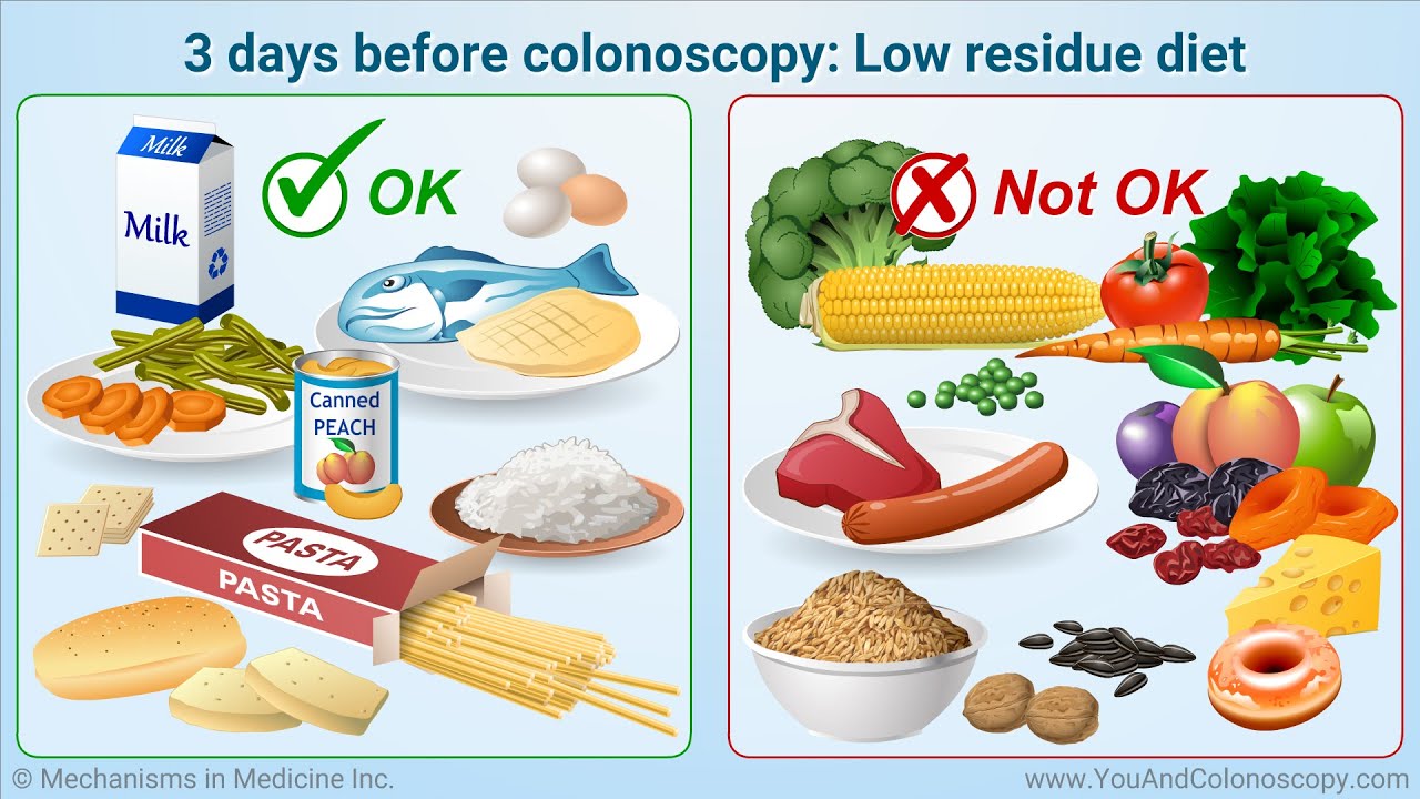 Effective Ways to Prepare for Your Colonoscopy Diet in 2025: Achieve Optimal Results