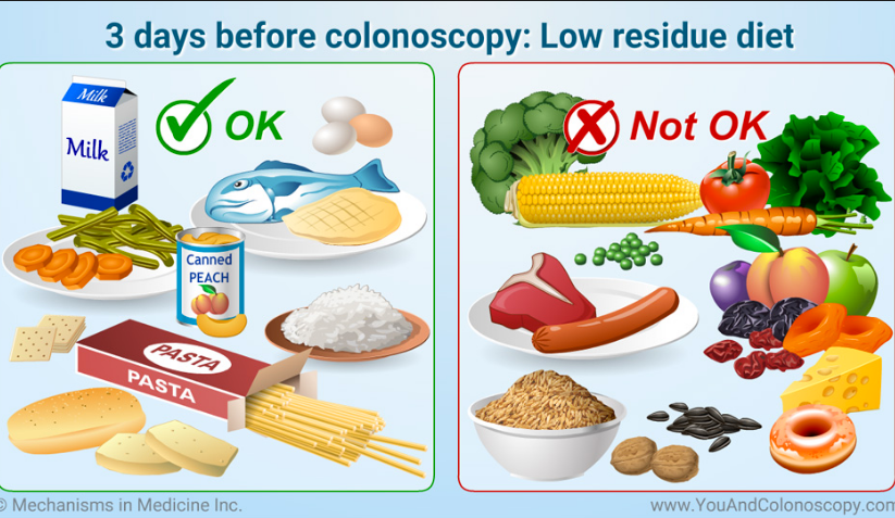 Essential Guide to Low Fiber Diet Before Colonoscopy: Prepare Effectively in 2025